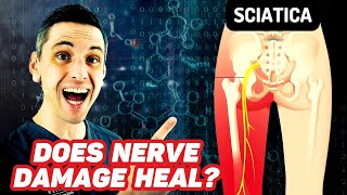 Does Sciatica Ever Heal Nerve Damage Recovery [upl. by Madian]