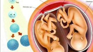 Everything You Need To Know About Fraternal and Identical Twins  Dr Sarah Finch [upl. by Viehmann]