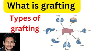 tissue graftinggraftingwhat is graftingtypes of graftingautograftisograftallograftxeno [upl. by Airat198]