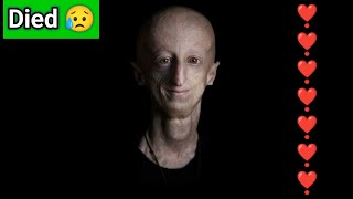 Survivor of rare rapidageing disease progeria dies at 28sammy basso fidanzata sammy basso età [upl. by Mya]