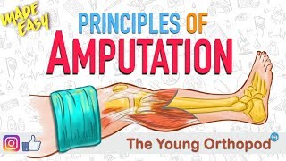 Amputation Principles  ANIMATION  BASICS  NEET PG  Amputee  The Young Orthopod [upl. by Bena]