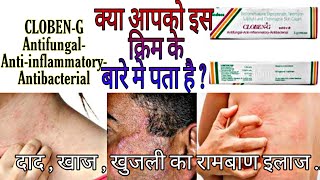 CLOBEN G CREAM l दाद खाज खुजली के लिए सबसे असरदार क्रीम cloben g cream BENIFITS amp REVIEW AND INFO [upl. by Nilyac]