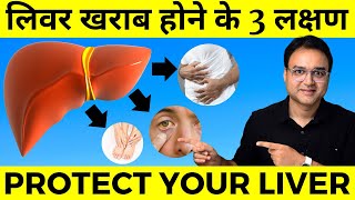 लिवर खराब होने के 3 लक्षण  3 Symptoms Of Liver Disease  Healthy Hamesha [upl. by Haldane]