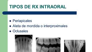 Video Conferencia Radiografia Dental [upl. by Shurlock]