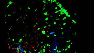 Movie 13 Directional extravasation of neutrophils from blood vessels toward the site [upl. by Della]