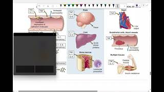 Into to pathology tissue inflammation 6 [upl. by Dawkins]