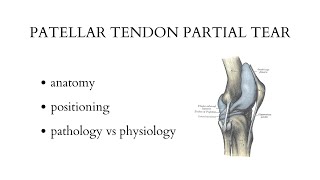 PATELLAR TENDON PARTIAL TEAR  musculoskeletal ultrasound examination [upl. by Tireb]