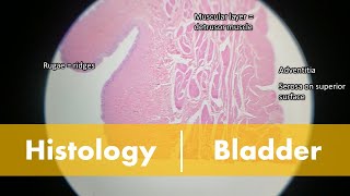 Histology of the Bladder [upl. by Llimaj]