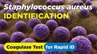 How to identify Staphylococcus aureus using the Coagulase Test  Slide and Tube Method [upl. by Iridissa]