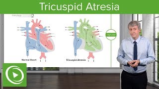 Tricuspid Atresia – Pediatric Cardiology  Lecturio [upl. by Nelhsa137]