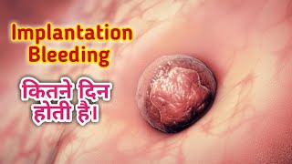 Implantation Bleeding कितने दिन तक होती है।।Implantation Bleeding।।NainaHealth555 [upl. by Riker]