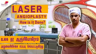 Laser angioplasty – How is it done [upl. by Adin]