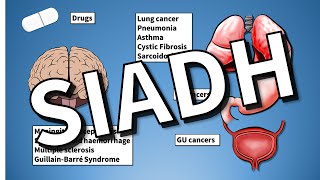 SIADH EXPLAINED Hyponatraemia [upl. by Mirak]