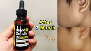 Ustraa advanced beard oil honest review 😥 [upl. by Larkins600]