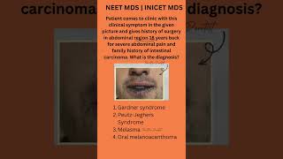 NEET MDS amp INICET MDS 2025 preparation  Oral pathology previous year important topic [upl. by Notterb]