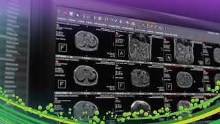 Visage 7  Overview Presentation  RSNA 2020 [upl. by Enelrae]