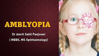 AMBLYOPIA  lazy eye EXPLAINED [upl. by Jill948]