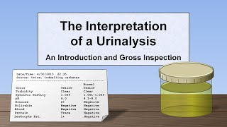 Interpretation of the Urinalysis Part 1  Introduction and Inspection [upl. by Cinimmod]