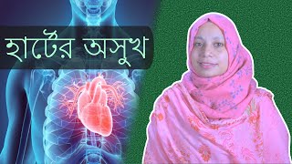 হার্টের অসুখের ১২টি লক্ষণ  হার্টের সমস্যার লক্ষণ  Heart Disease Symptoms in Bangla [upl. by Hau]