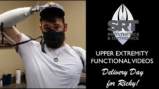 Upper Extremity Amputee Success Ricky [upl. by Naivaf434]