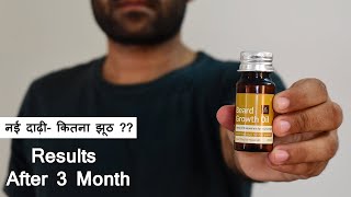 Ustraa Beard growth oil Review in Hindi 2022  3 Months Result [upl. by Ennagem989]