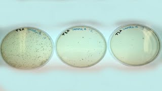 2 Level 3 Microbiology  Microbiology analysis of shrimp [upl. by Norramic]