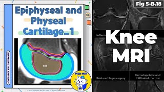 Fig 5B18 Normal Epiphyseal and Physeal Cartilage Part 1 [upl. by Alorac]