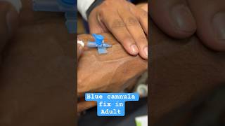 Intravenous cannulation for Adult  trending hospital doctor cannula SMpharmacy plz follow [upl. by Rella]