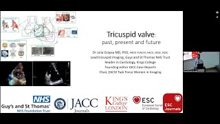 Tricuspid valve past present and future by Dr Grapsa [upl. by Aniretake8]