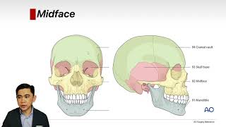 Midface Lecture [upl. by Ploch]