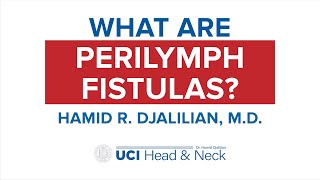 What are Perilymph Fistulas by Dr Hamid Djalilian  UCI Head amp Neck [upl. by Adnoma]