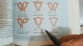 Genital System Embryology Clinicals  Reproductive System  Langman Embryology [upl. by Vince]