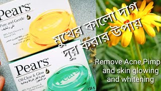 ত্বকে pears soap এর কাজ কিমাত্র একটি pears soapব্যবহার করলে মুখের যেকোনো কালো দাগ দূর হয়ে যাবে [upl. by Ivers]