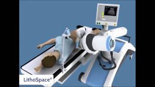 Litotriptor LithoSpace  Jena MedTech [upl. by Xymenes]