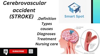 Brain strokeCVA Definitiontypes causesdiagnosestreatment Nursing care GBSN  pathophysiology [upl. by Godding814]