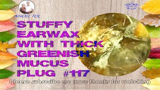 Stuffy Earwax With Thick GREENISH Mucus Plug 117 [upl. by Nylhsoj]