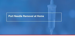 Port Needle Removal at Home [upl. by Nivek404]