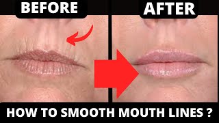 SMOKER LINES  HOW TO GET RID OF LIP WRINKLES  FACE YOGA AND FACE MASSAGE [upl. by Azalea]