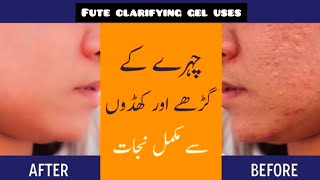 Fute clarifying gel use l treatment of acne amp dul skin l bnft amp effect ful revew by aneespharmacist [upl. by Nanyt]