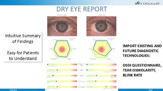 Online Seminar Erich Mack Keratograph 5M Dry Eye Technology [upl. by Rocco]