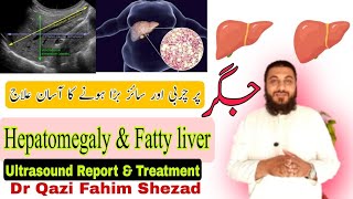 Hepatomegalyfatty liver treatment Symptomsultrasound Jigar py charbi [upl. by Aicemed]