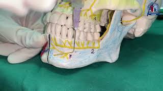 Incisive Nerve Block [upl. by Caraviello]