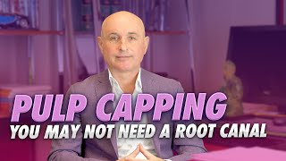 Pulp Capping  You May Not Need the Root Canal [upl. by Gytle8]