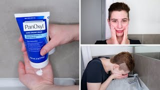 How to use PanOxyl 4 Benzoyl Peroxide Acne Creamy Wash [upl. by Schaeffer]