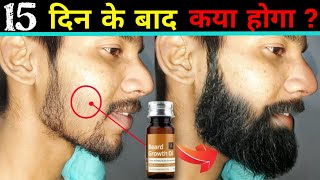 Ustraa Beard Growth Oil Review in Hindi 2024  Best Beard Oil For Extreme Growth  How to Grow Beard [upl. by Nirik157]