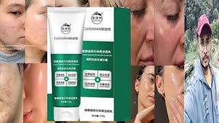 Cuishifan Whitening Freckle Removing Facial Cleanser  Honest Review [upl. by Sihtnyc]