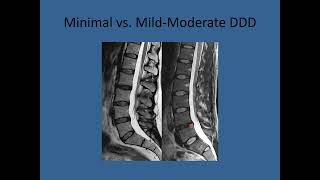 How to read an MRI  MRI image Interpretation [upl. by Bunni]