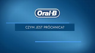 Co to jest próchnica zębów [upl. by Trahern]