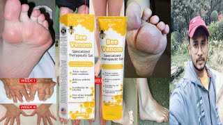 Bee Venom Joint Therapy Pain Relief Gel  Honest Review [upl. by Allac]