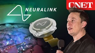 Elon Musk’s Neuralink Event Everything Revealed in 10 Minutes [upl. by Etterb]